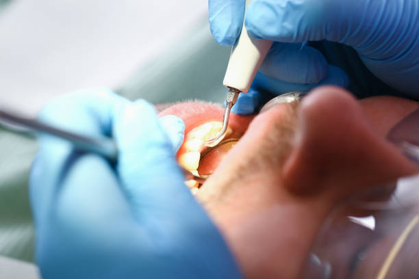 Best Emergency Dental Care for Trauma or Injury in Rothschild, WI